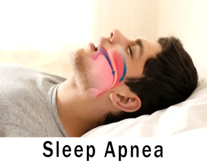 آپنه خواب و سلامت دراز مدت